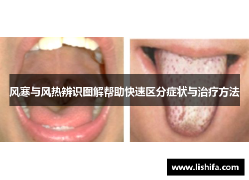风寒与风热辨识图解帮助快速区分症状与治疗方法